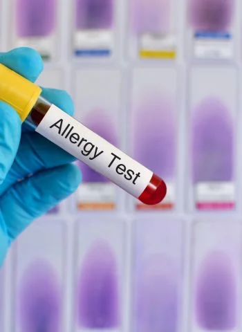 Allergy Testing & Immunotherapy